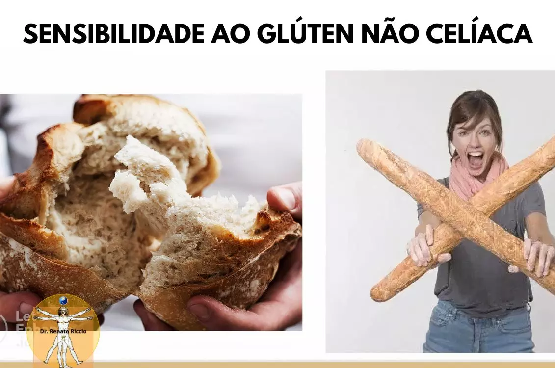 Sensibilidade ao Glúten Não-Celíaca